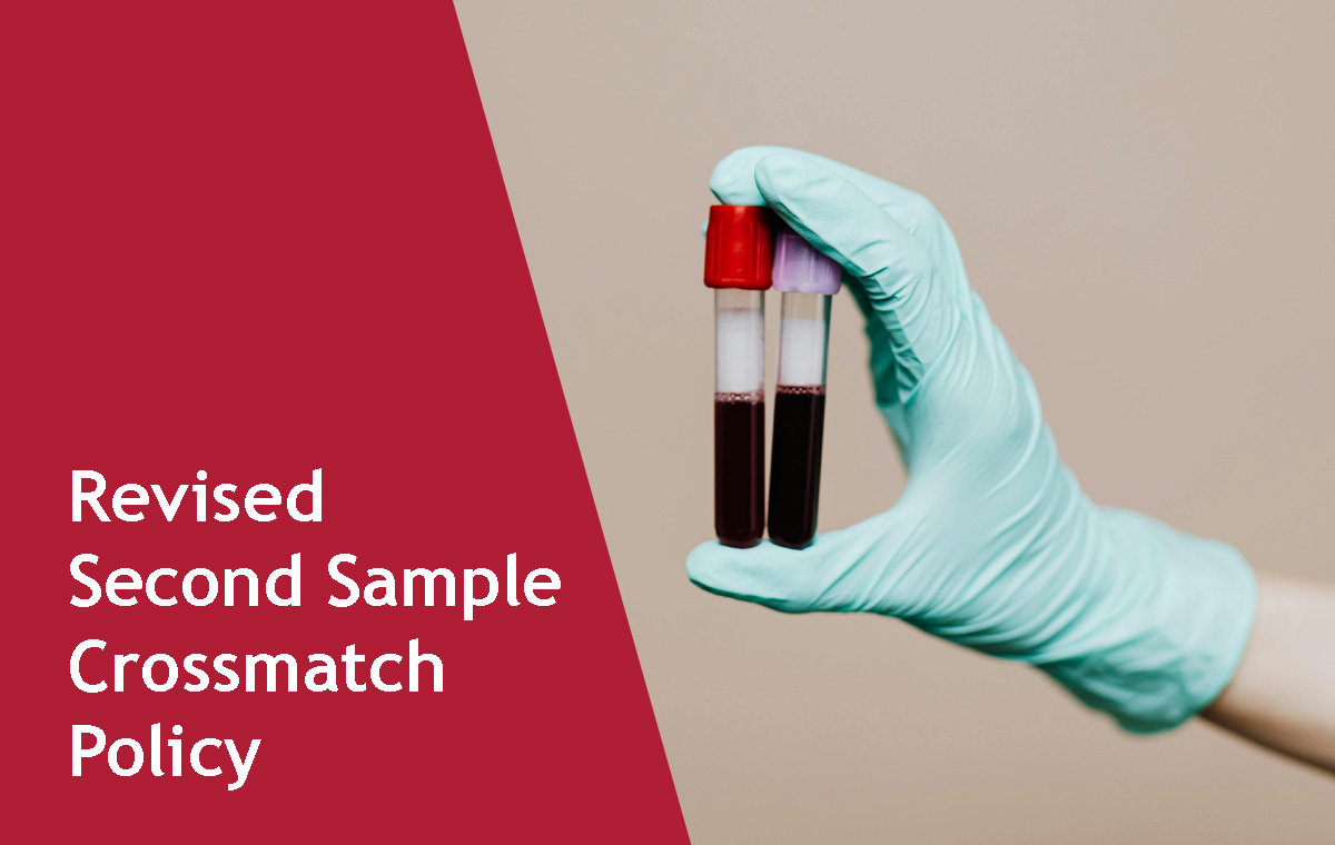 Revised Second Sample Crossmatch Policy Improves Turnaround Time from 120 to 90 Minutes