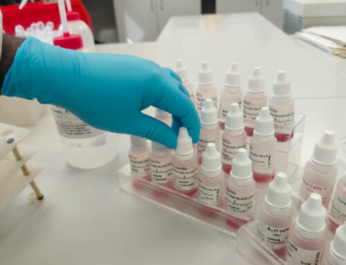 What Happens After You Donate Blood? Inside the Reagents Laboratory